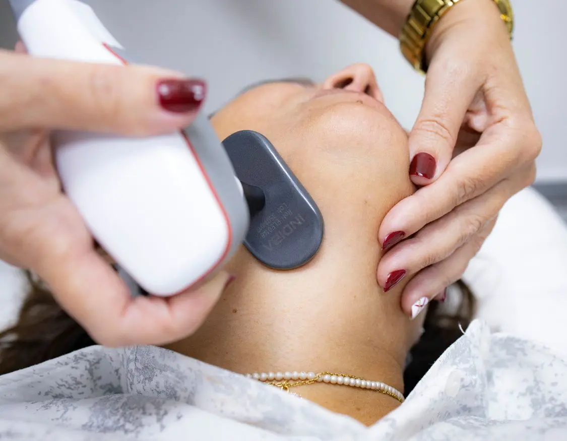 Persona recibiendo tratamiento estético facial con Indiba en el cuello